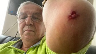 Ankara Emniyet Müdürlüğü’nden Uğuroğlu’na yapılan saldırıyla ilgili açıklama: 3 kişi yakalandı; bir kişi aranıyor